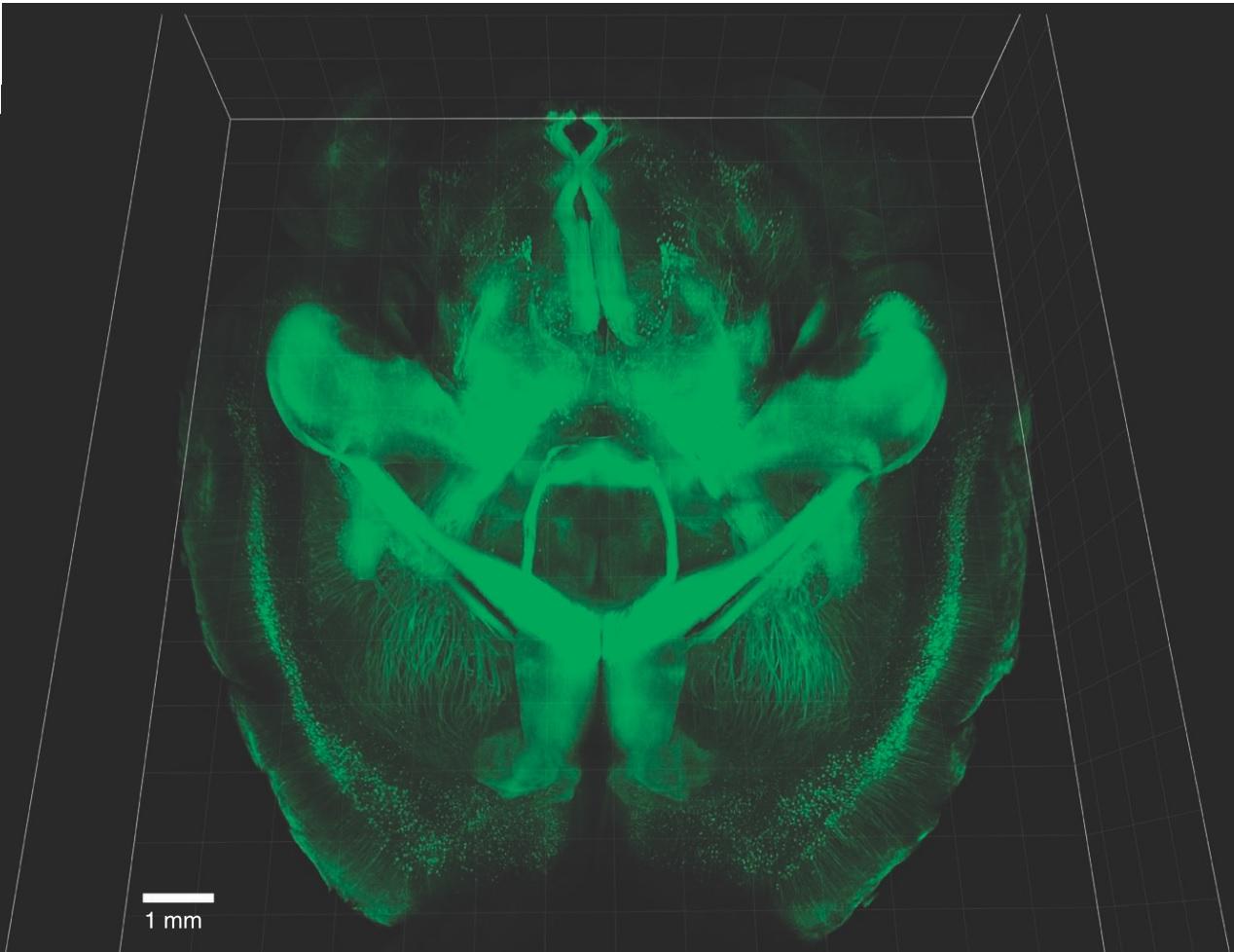 Intact Adult Mouse Brain Imaging. Credit: Chung & Deisseroth, 2013 